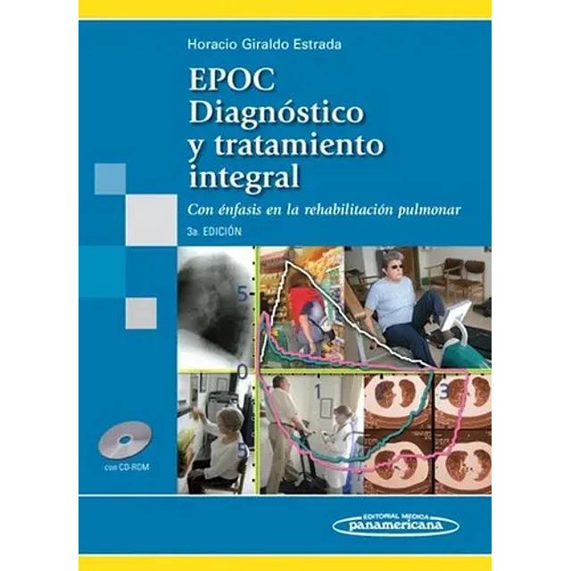 EPOC Diagnóstico y tratamiento integral