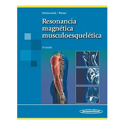 Resonancia Magnética Musculoesqueletica