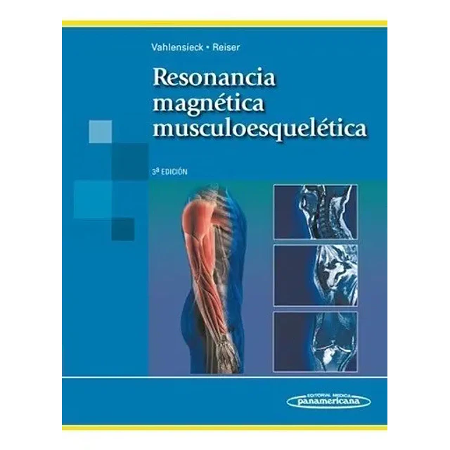 Resonancia Magnética Musculoesqueletica
