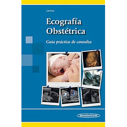 Ecografía obstétrica