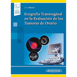 Ecografía Transvaginal en la Evaluación de los Tumores de Ovario