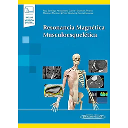 Resonancia Magnética Musculoesquelética
