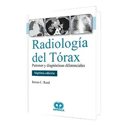 Radiología del Tórax