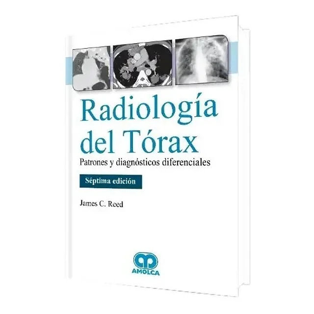 Radiología del Tórax