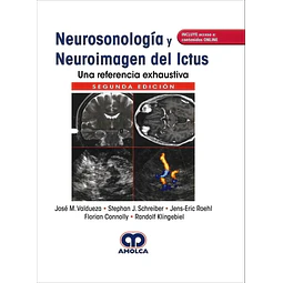 Neurosonología y neuroimagen del ictus