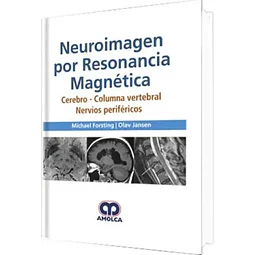 Neuroimagen por resonancia magnética