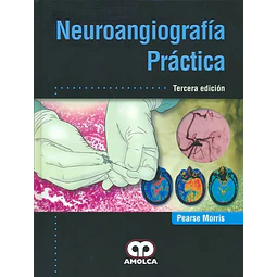 Neuroangiografía Práctica