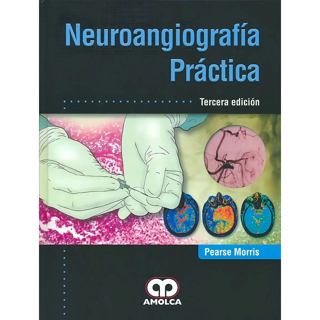 Neuroangiografía Práctica