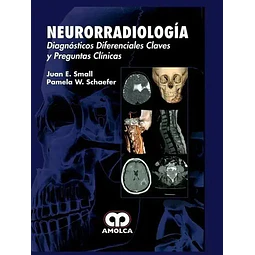 Neurorradiología