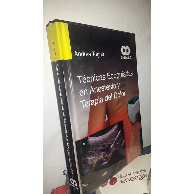 Técnicas ecoguiadas en anestesia y terapia del dolor