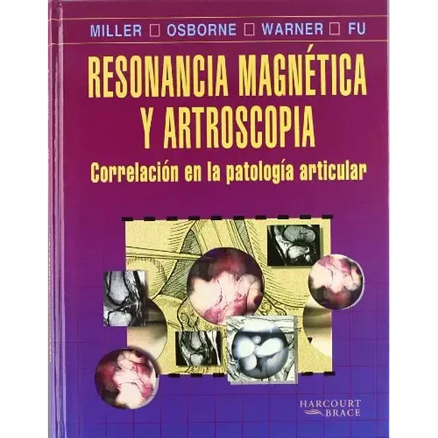Resonancia magnetica y artroscopia : correlacion en la patologia articular