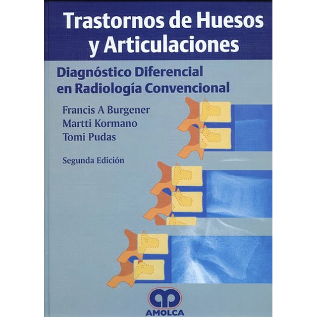 Trastornos de Huesos y Articulaciones