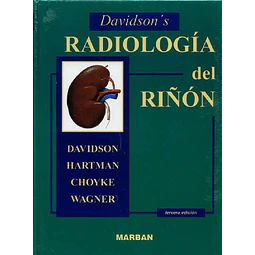 Radiología del riñón Davidson' s