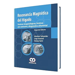 Resonancia Magnética del Hígado