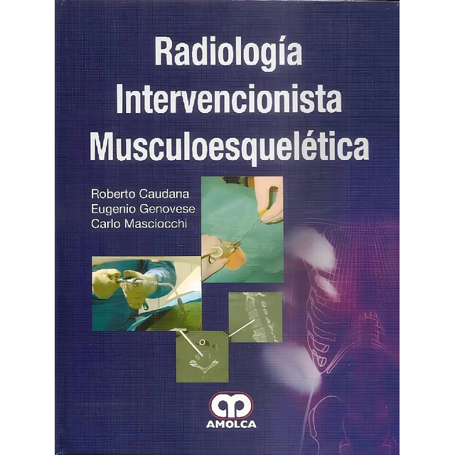 Radiología Intervencionista Musculoesquelética
