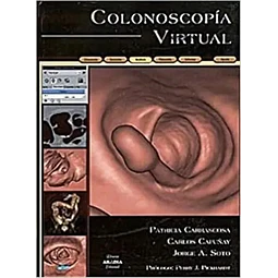 Colonoscopía Virtual
