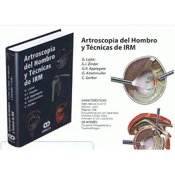 Artroscopia del Hombro y Técnicas de IRM