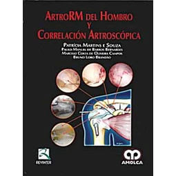ArtroRM del Hombro y Correlacion Artroscopica