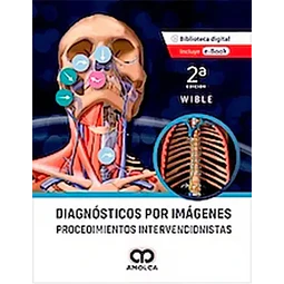 Diagnósticos por imágenes - Procedimientos Intervencionistas.