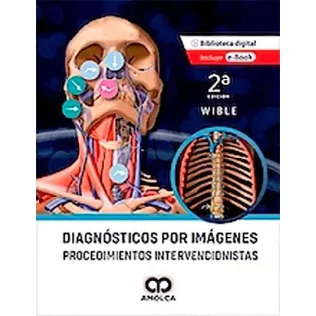 Diagnósticos por imágenes - Procedimientos Intervencionistas.