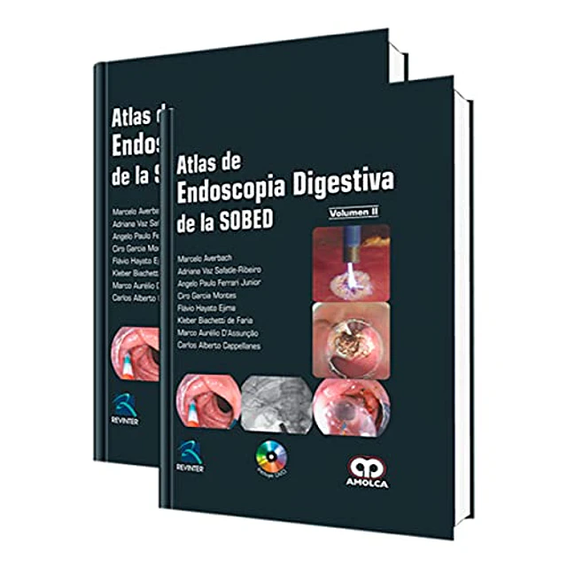 Atlas de Endoscopia Digestiva de la SOBED - 2 Tomos
