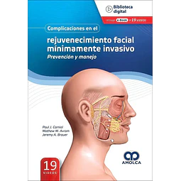Complicaciones en el rejuvenecimiento facial mínimamente invasivo.Prevención y manejo