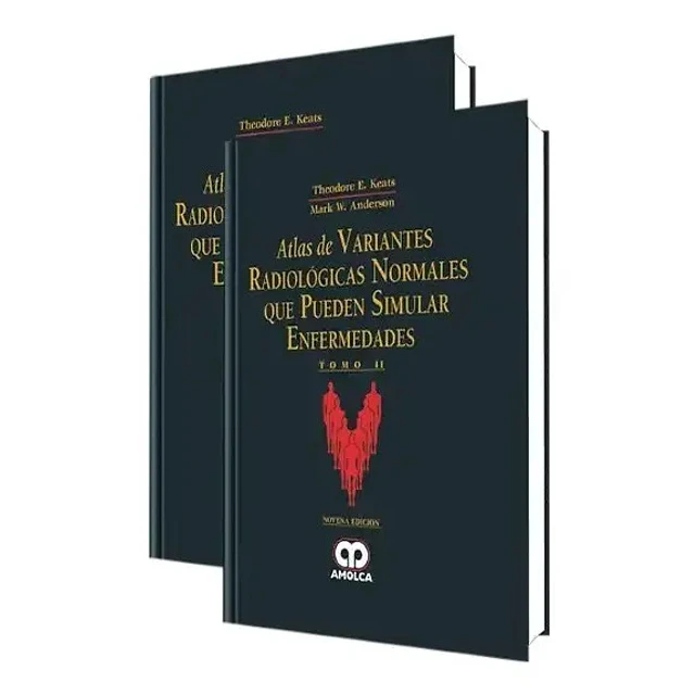 Atlas de Variantes Radiológicas Normales que Pueden Simular Enfermedades - 2 Tomos