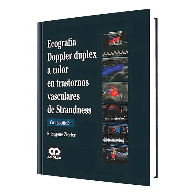 Ecografía Doppler Duplex a color en trantornos vasculares de Strandness