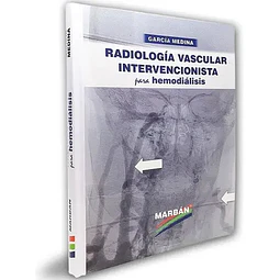 Radiología Vascular Intervencionista para Hemodiálisis