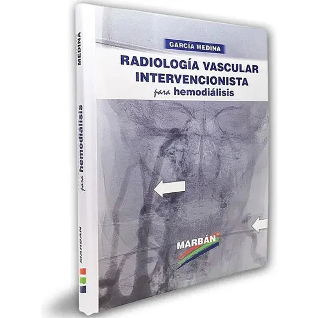 Radiología Vascular Intervencionista para Hemodiálisis
