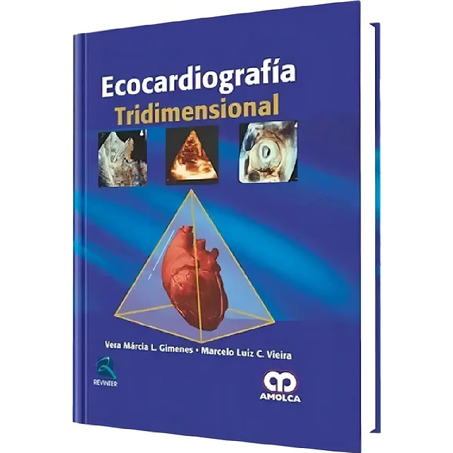 Ecocardiografía Tridimensional