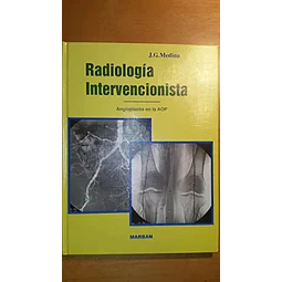 Radiología intervencionista: angioplastia en la arterioesclerosis obliterante periférica