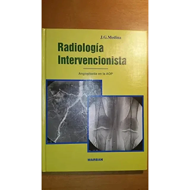 Radiología intervencionista: angioplastia en la arterioesclerosis obliterante periférica