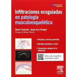 Infiltraciones ecoguiadas en patología musculoesqueletica