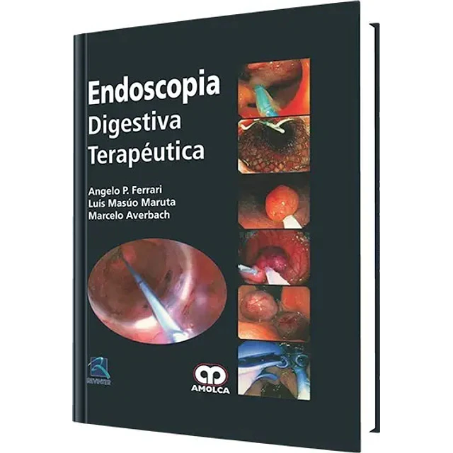 Endoscopia Digestiva Terapéutica