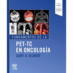 Fundamentos de la PET-TC en oncología