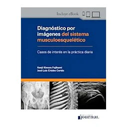 Diagnóstico por Imágenes del sistema musculoesquelético