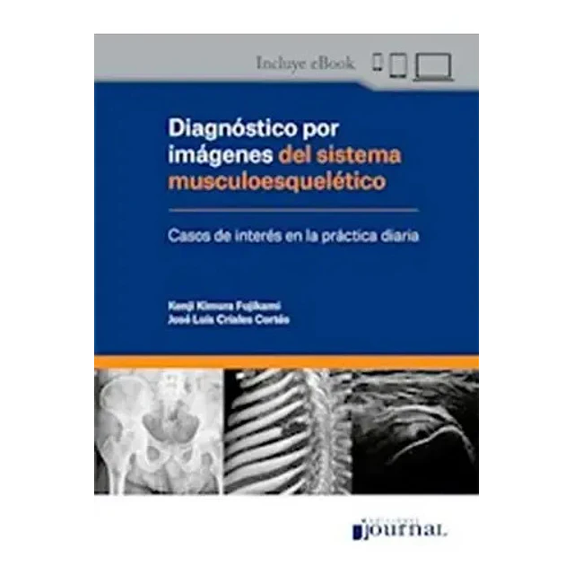 Diagnóstico por Imágenes del sistema musculoesquelético