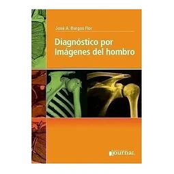 Diagnóstico por Imágenes del Hombro