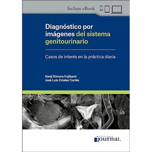 Diagnóstico por imágenes del sistema genitourinario