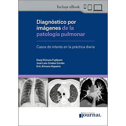 Diagnóstico por imágenes de la patología pulmonar