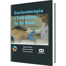 Escleroterapia y Tratamiento de las Venas