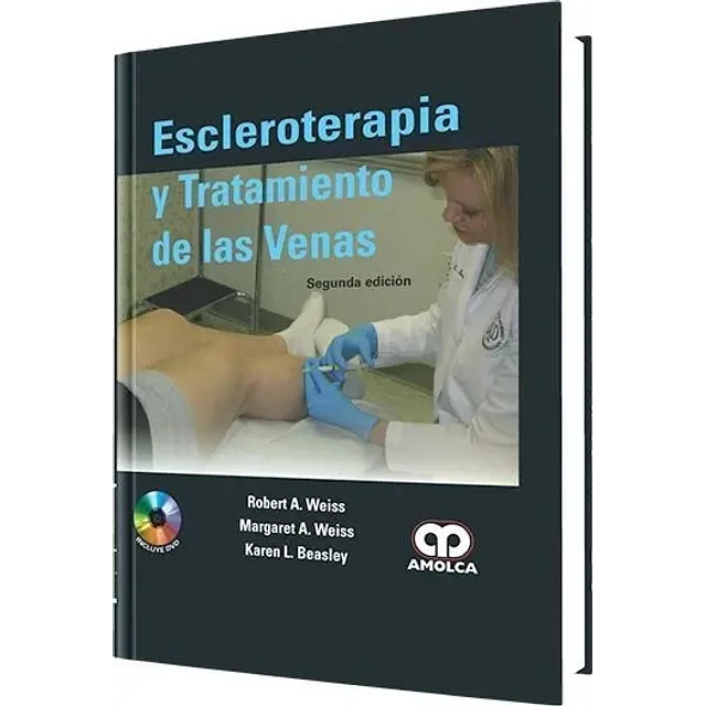 Escleroterapia y Tratamiento de las Venas
