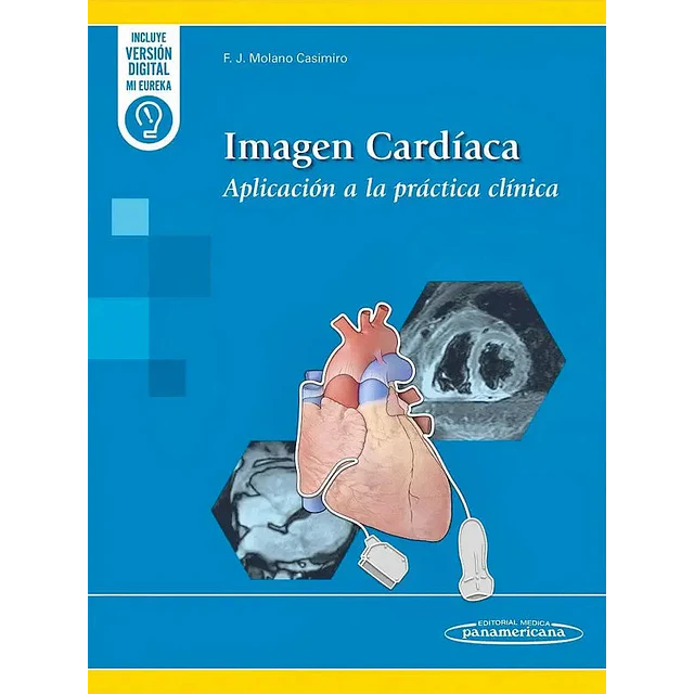 Imagen cardíaca. Aplicación práctica clínica