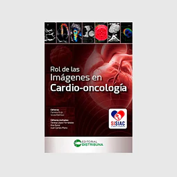 Rol de las imágenes en cardio-oncología