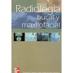 Radiologia Bucal y Maxilofacial
