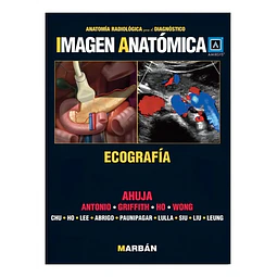 Ecografía Anatomía Radiológica para el Diagnóstico Imagen Anatómica