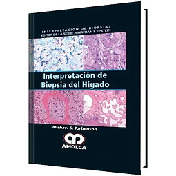 Interpretación de biopsia del hígado