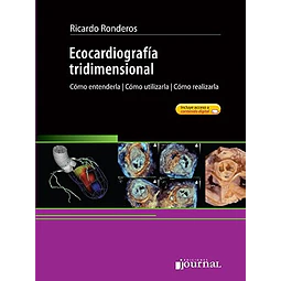 Ecocardiogragía tridimensional