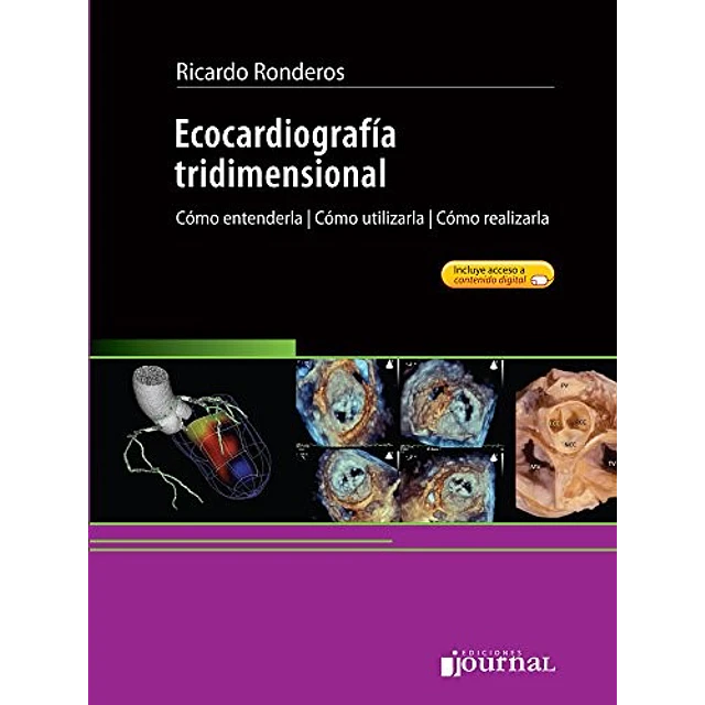 Ecocardiogragía tridimensional